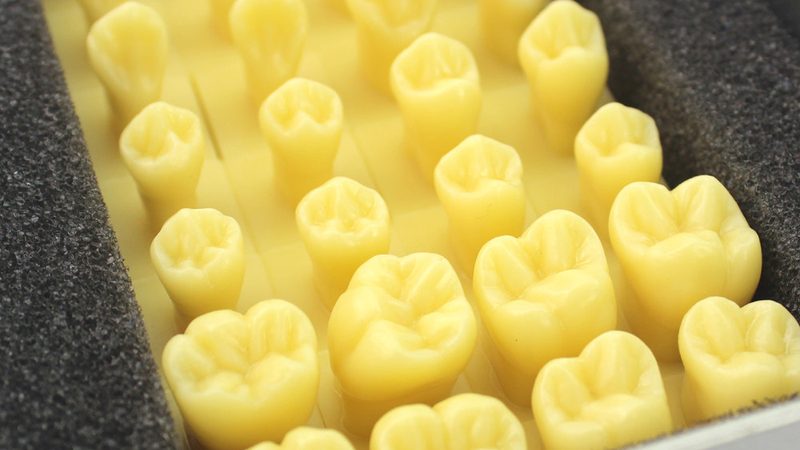 牙周炎治疗费用价格表